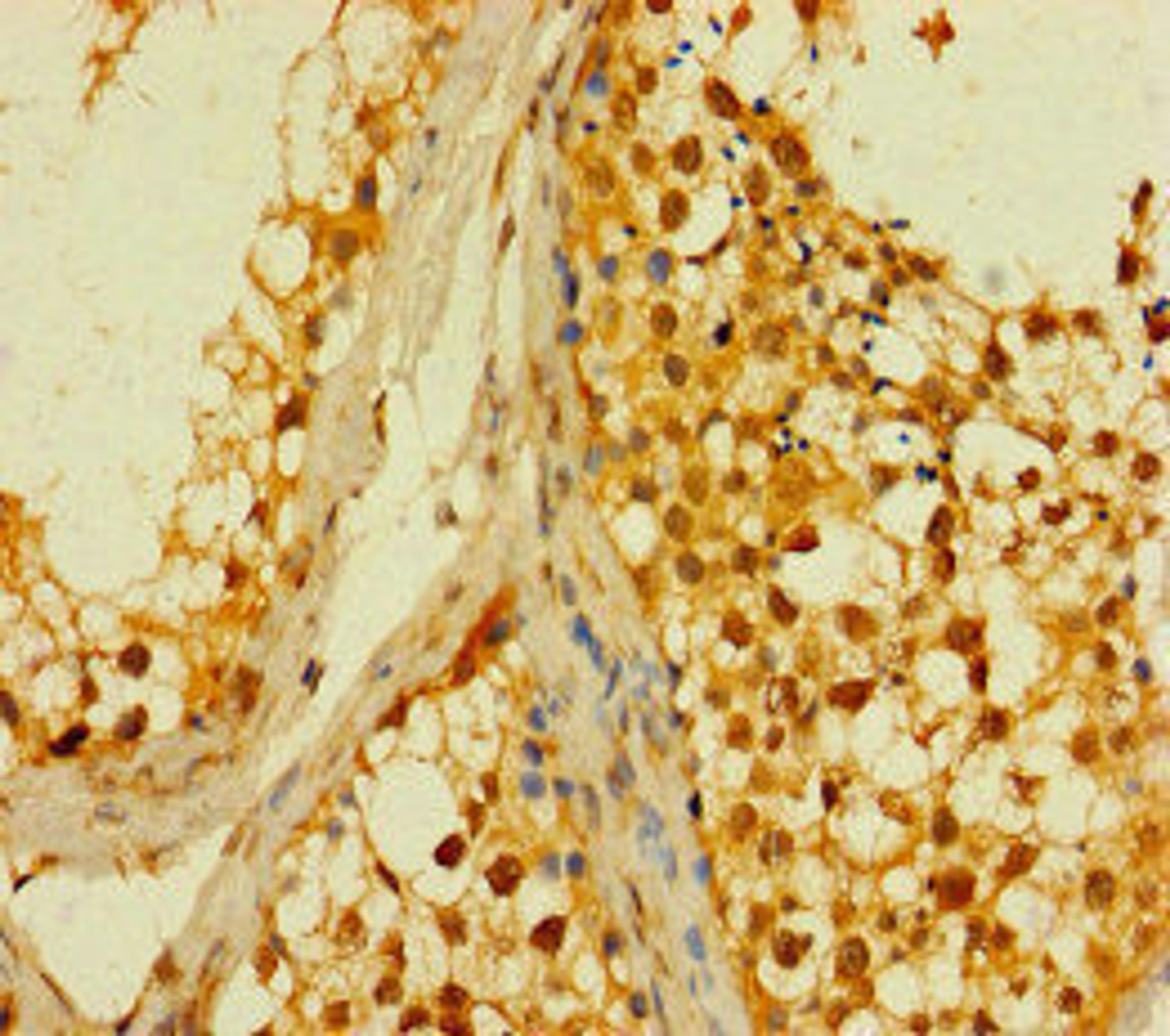 Immunohistochemistry of paraffin-embedded human testis tissue using CSB-PA836649LA01HU at dilution of 1:100