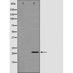 Western blot analysis of human brain cell lysate using CRH antibody