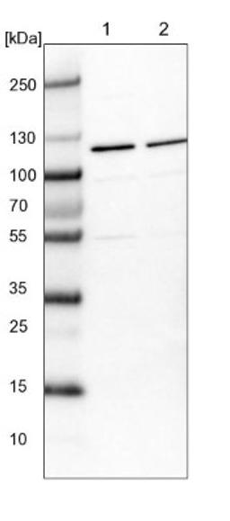 Western Blot: RNF17 Antibody [NBP1-83782] - Lane 1: NIH-3T3 cell lysate (Mouse embryonic fibroblast cells)<br/>Lane 2: NBT-II cell lysate (Rat Wistar bladder tumour cells)