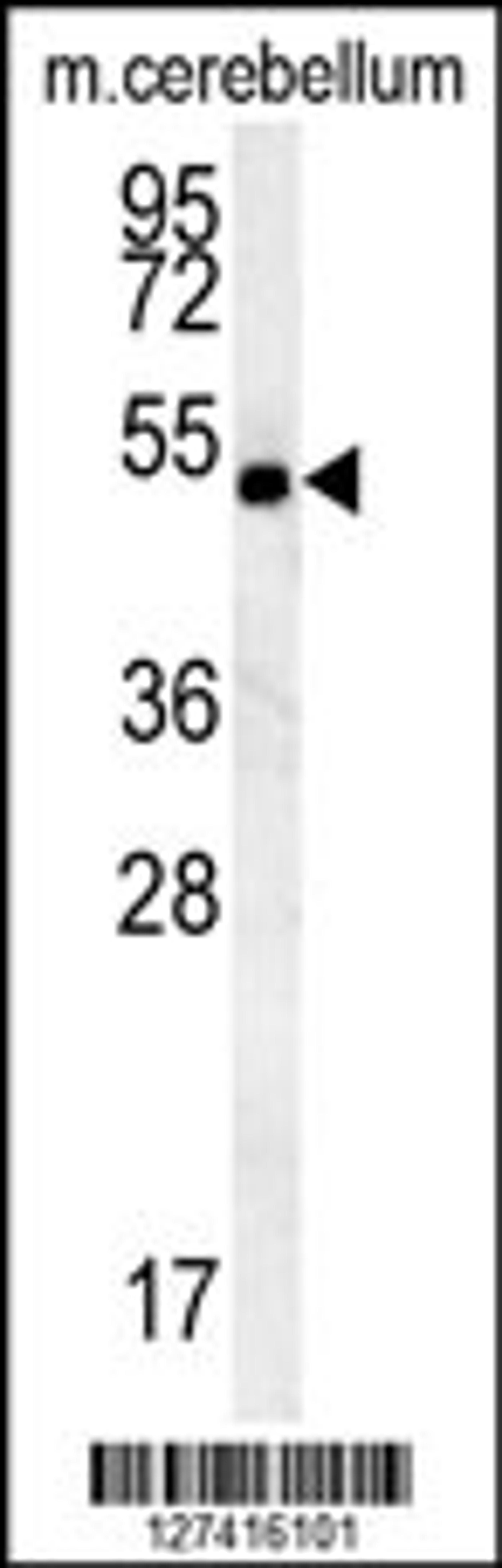 Western blot analysis in mouse cerebellum tissue lysates (15ug/lane).This demonstrates thedetected CG_2039146 protein (arrow).