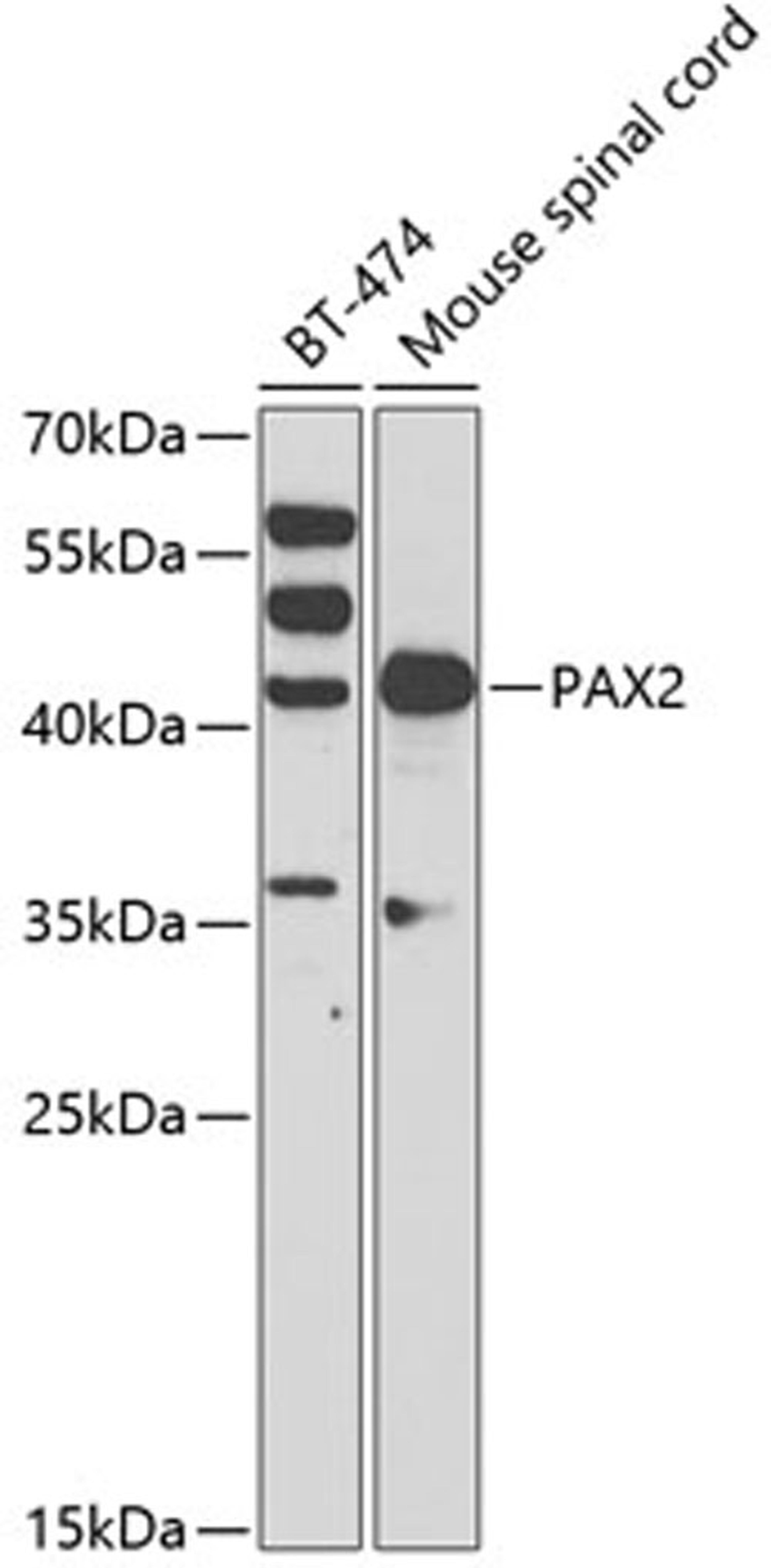 Western blot - PAX2 antibody (A3067)