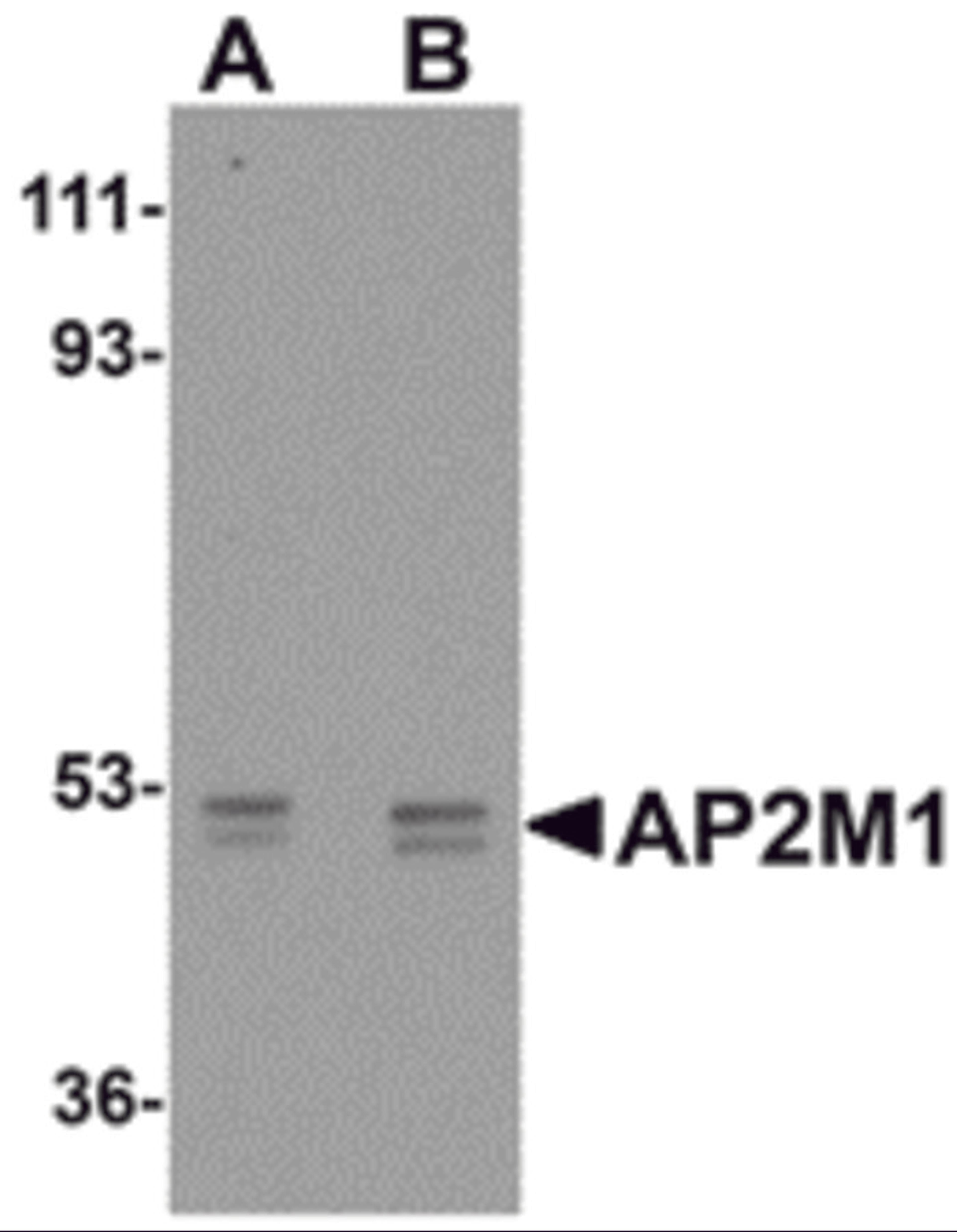 Western blot analysis of AP2M1 in human kidney tissue lysate with AP2M1 antibody at (A) 1 and (B) 2 &#956;g/mL.