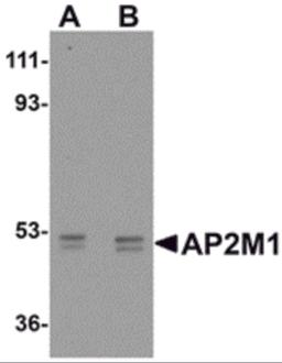 Western blot analysis of AP2M1 in human kidney tissue lysate with AP2M1 antibody at (A) 1 and (B) 2 μg/mL.