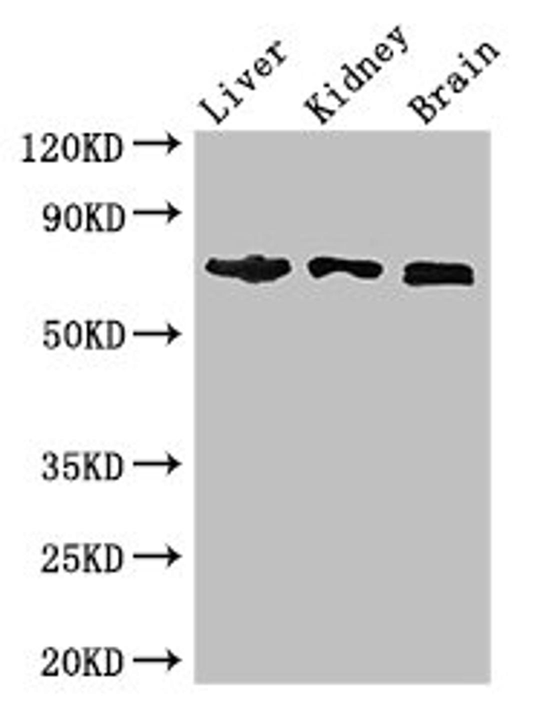 Western Blot. Positive WB detected in: Mouse liver tissue, Mouse kidney tissue, Mouse brain tissue. All lanes: TCF4 antibody at 2.7ug/ml. Secondary. Goat polyclonal to rabbit IgG at 1/50000 dilution. Predicted band size: 72, 55, 49, 66, 65, 58, 68, 64, 70, 69, 63 kDa. Observed band size: 72 kDa. 
