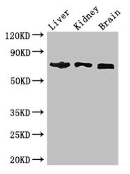 Western Blot. Positive WB detected in: Mouse liver tissue, Mouse kidney tissue, Mouse brain tissue. All lanes: TCF4 antibody at 2.7ug/ml. Secondary. Goat polyclonal to rabbit IgG at 1/50000 dilution. Predicted band size: 72, 55, 49, 66, 65, 58, 68, 64, 70, 69, 63 kDa. Observed band size: 72 kDa. 