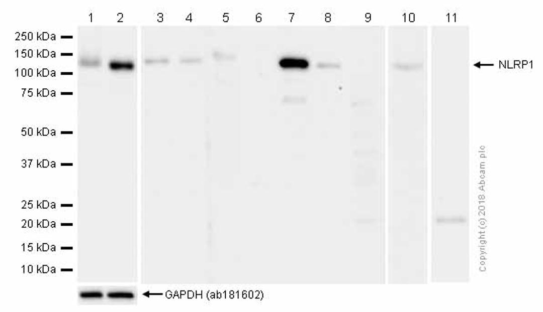 Western blot - Anti-NLRP3 antibody [EPR20425] (ab210491)