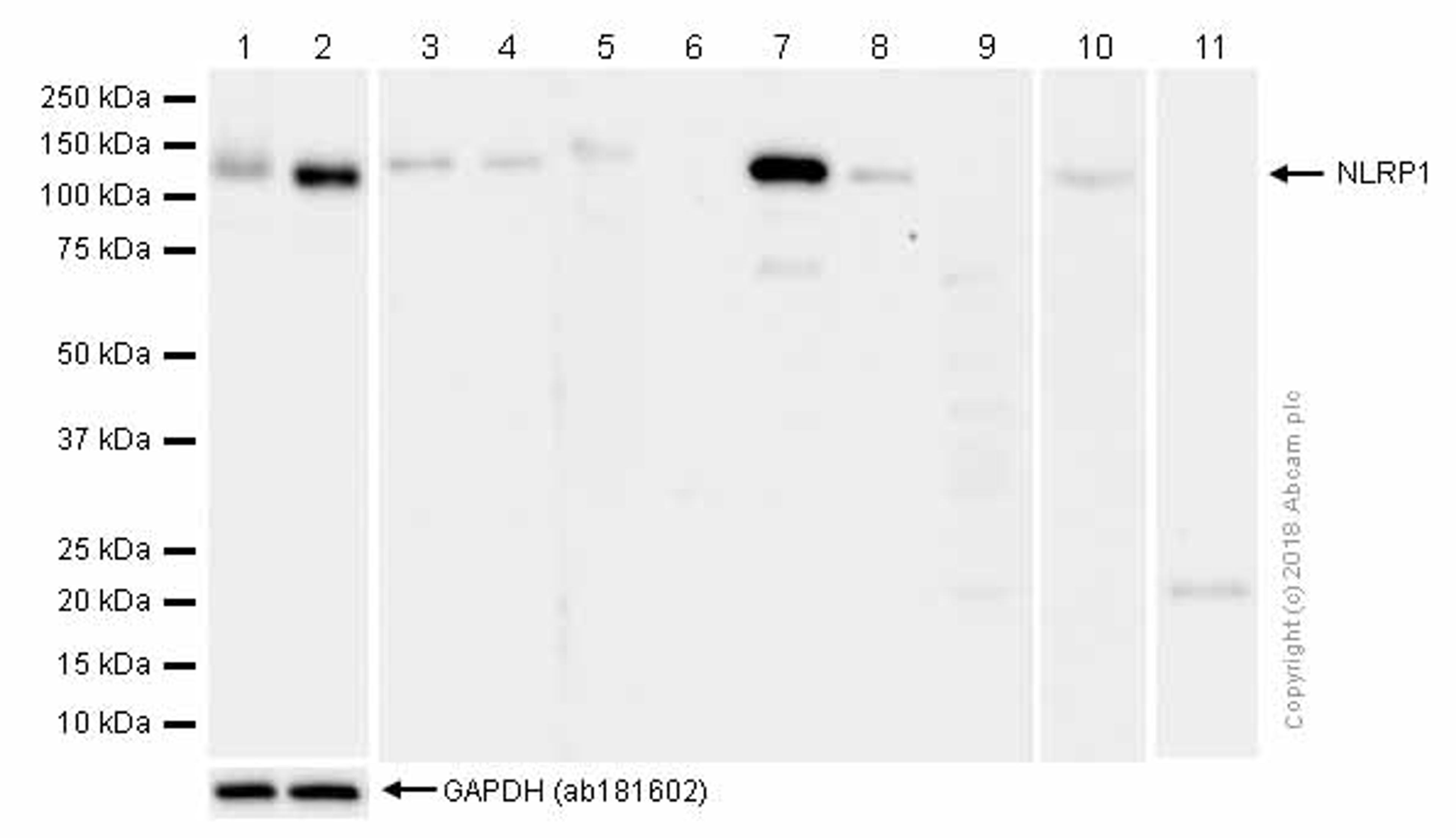 Western blot - Anti-NLRP3 antibody [EPR20425] (ab210491)