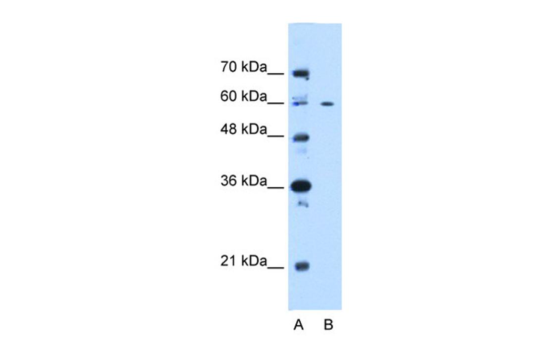 Antibody used in WB on Human 721_B at 0.2-1 ug/ml.