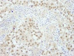 Detection of human BRCA1 by immunohistochemistry.