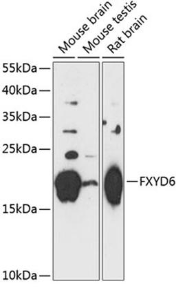 Western blot - FXYD6 antibody (A14339)