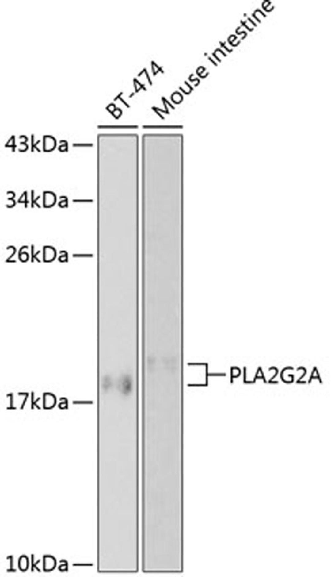 Western blot - PLA2G2A antibody (A1234)