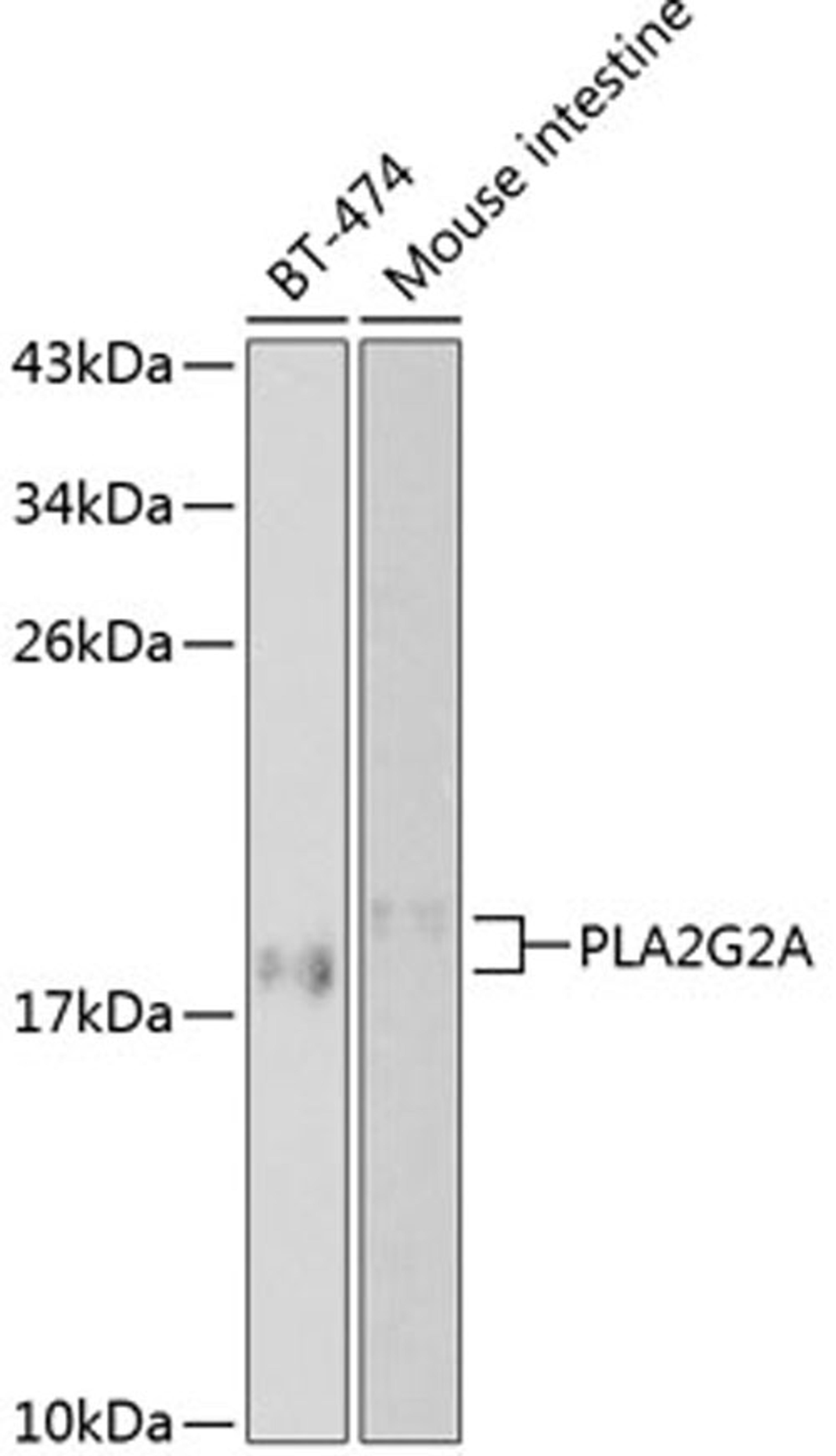 Western blot - PLA2G2A antibody (A1234)