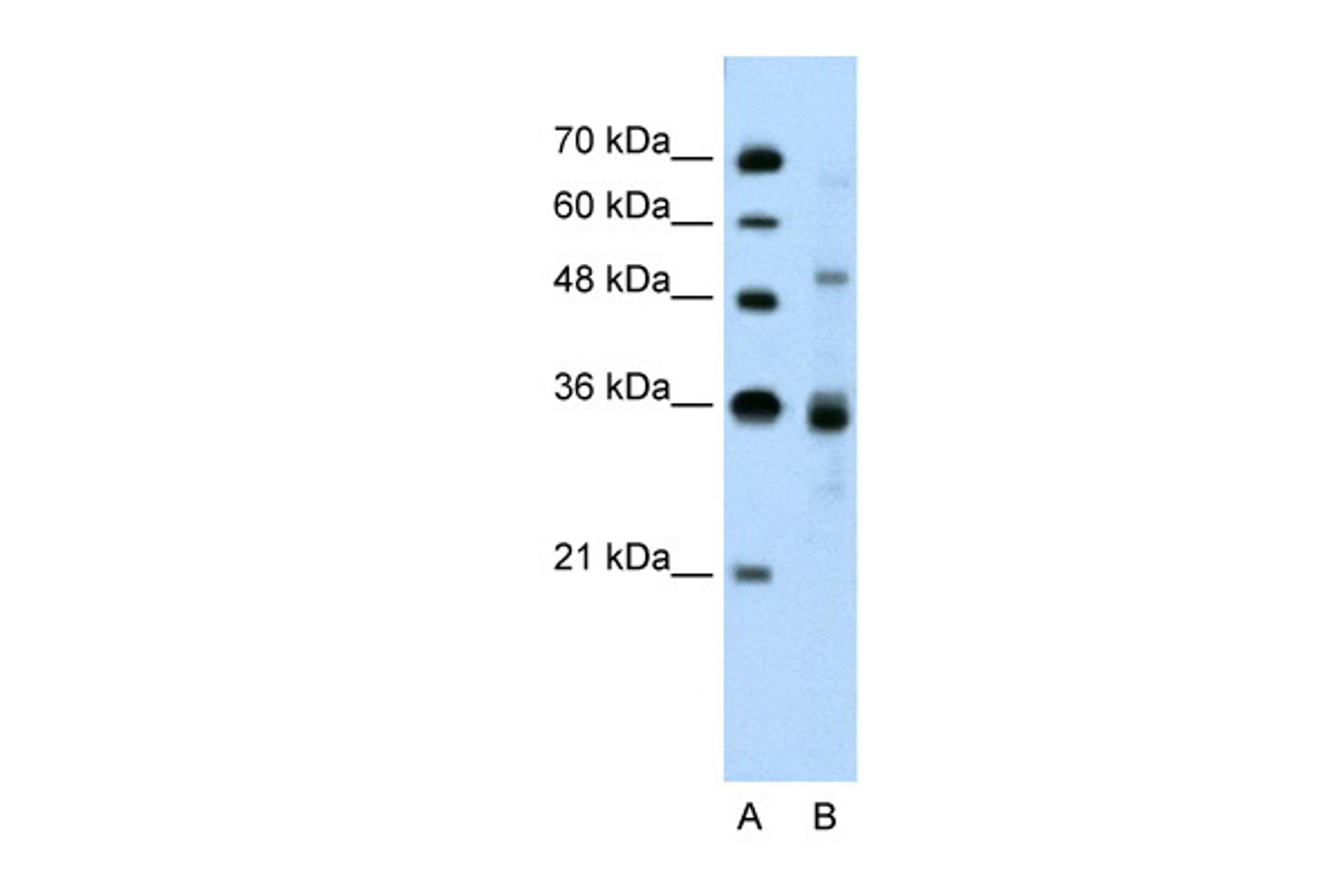 Antibody used in WB on Human Jurkat 0.2-1 ug/ml.