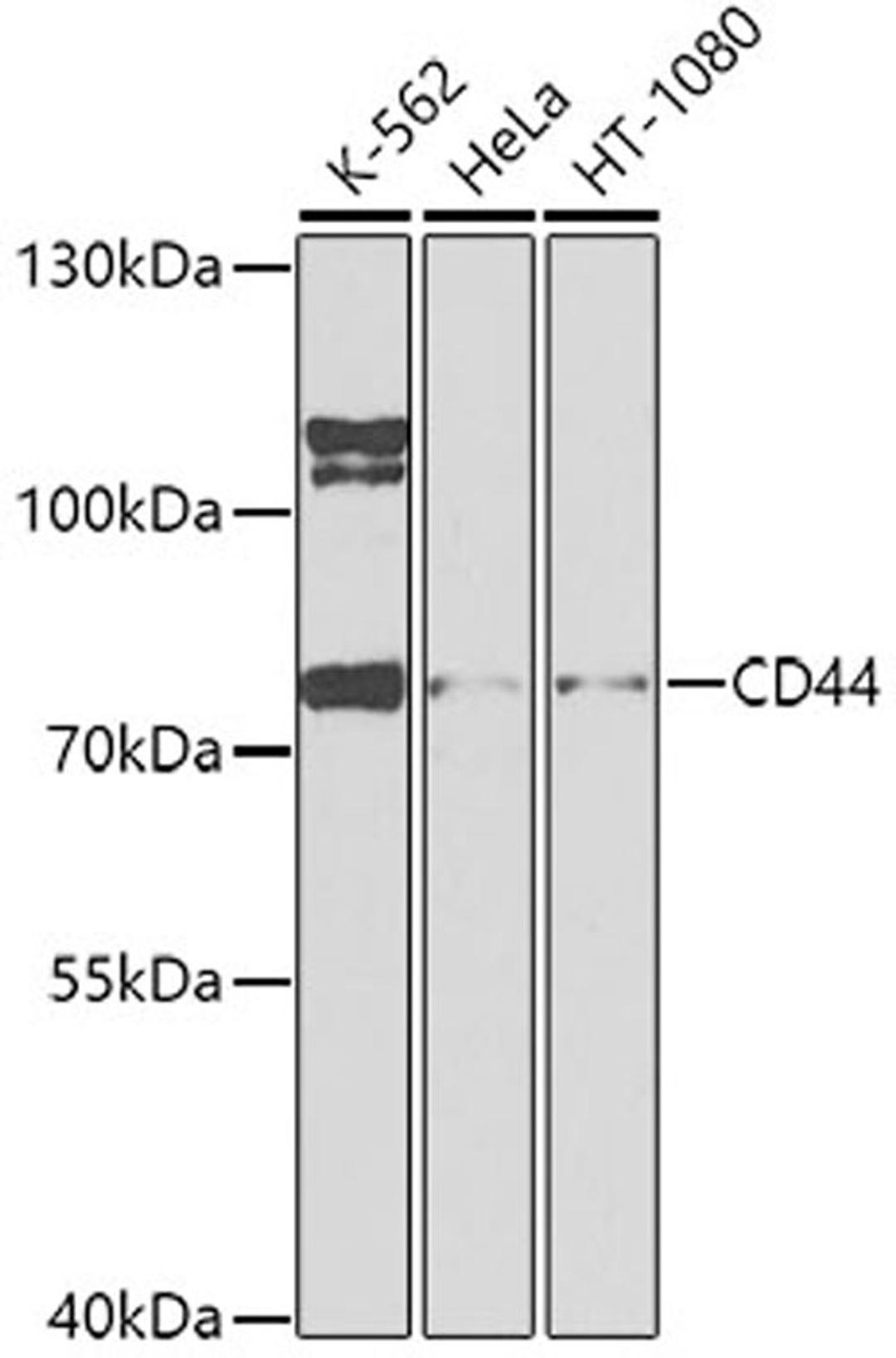 Western blot - CD44 antibody (A0340)