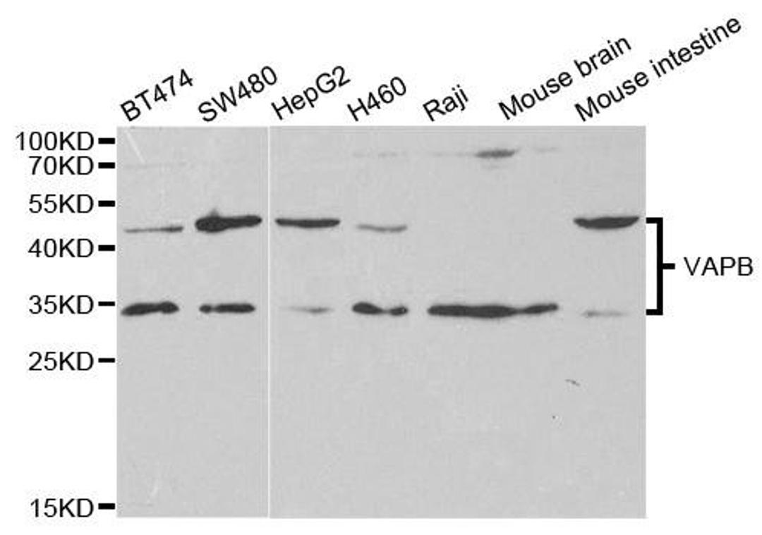 Western blot analysis of extracts of various cell lines using VAPB antibody