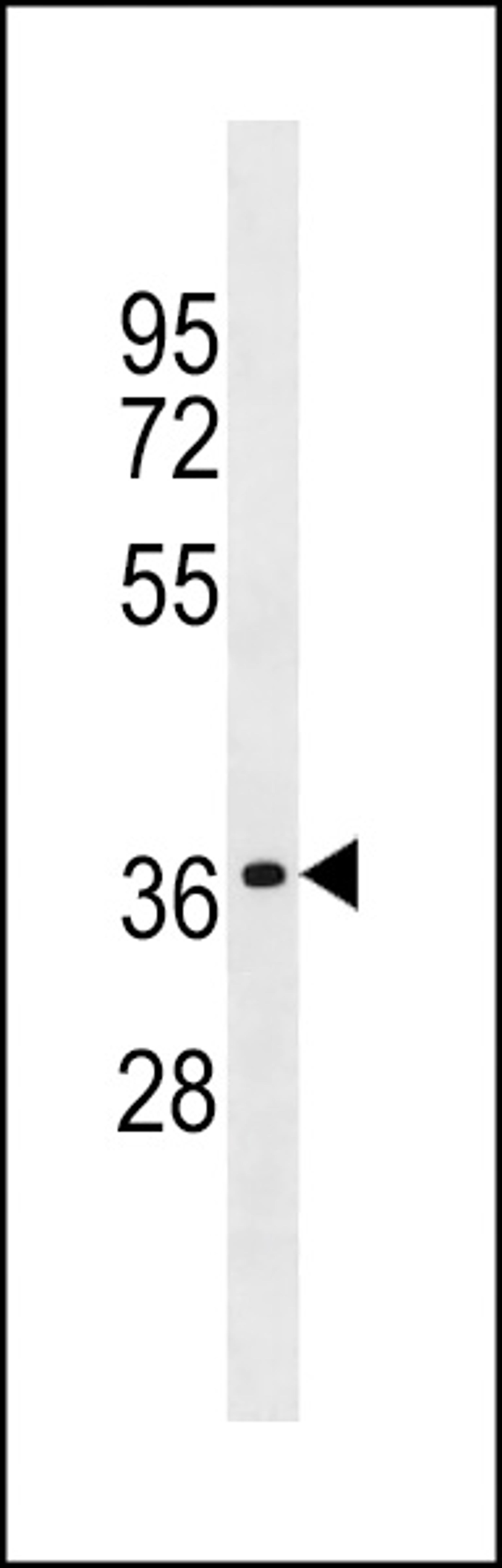 Western blot analysis in A549 cell line lysates (35ug/lane).