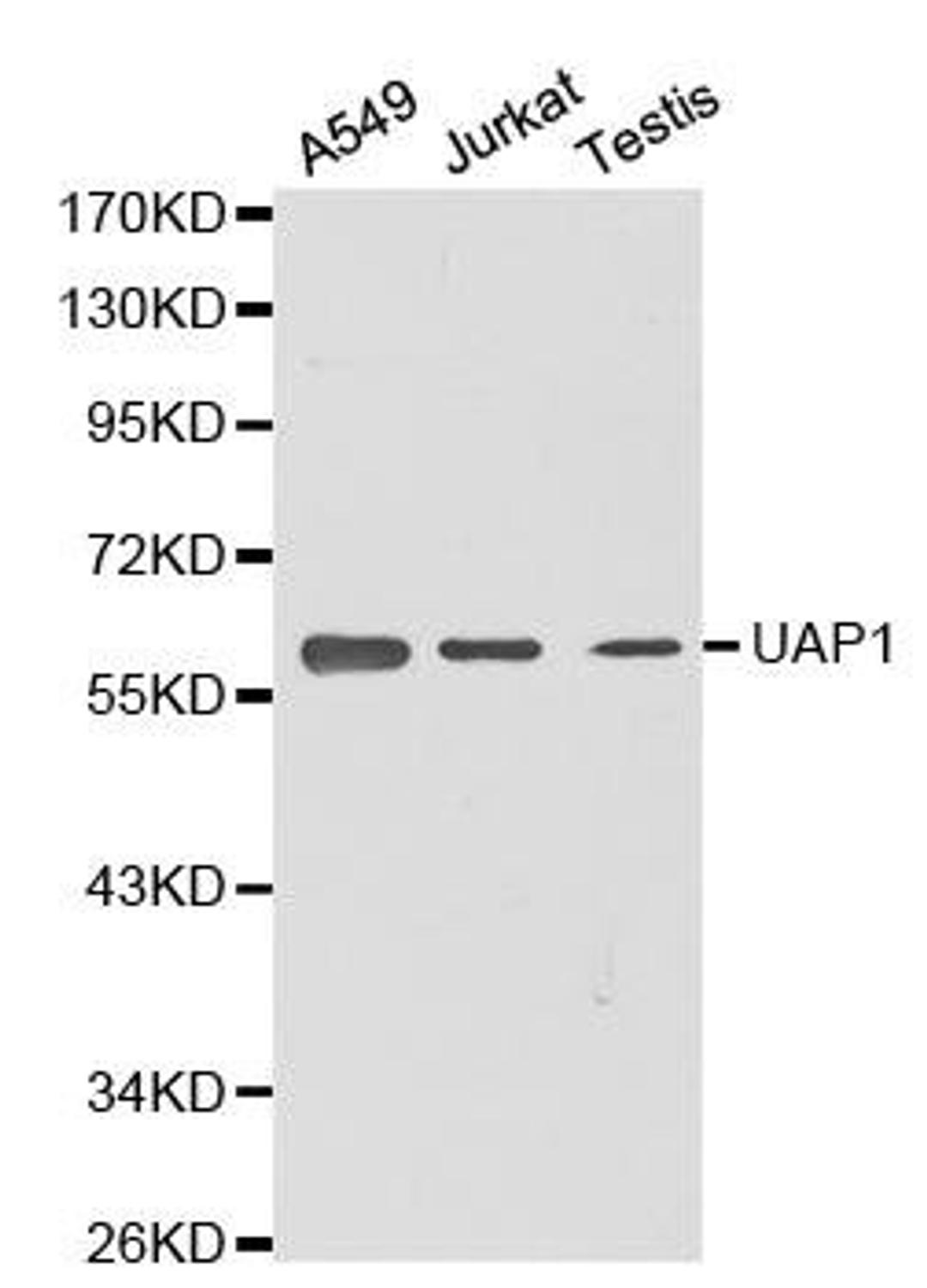 Western blot analysis of extracts of various cell lines using UAP1 antibody