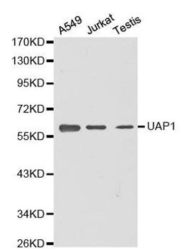 Western blot analysis of extracts of various cell lines using UAP1 antibody