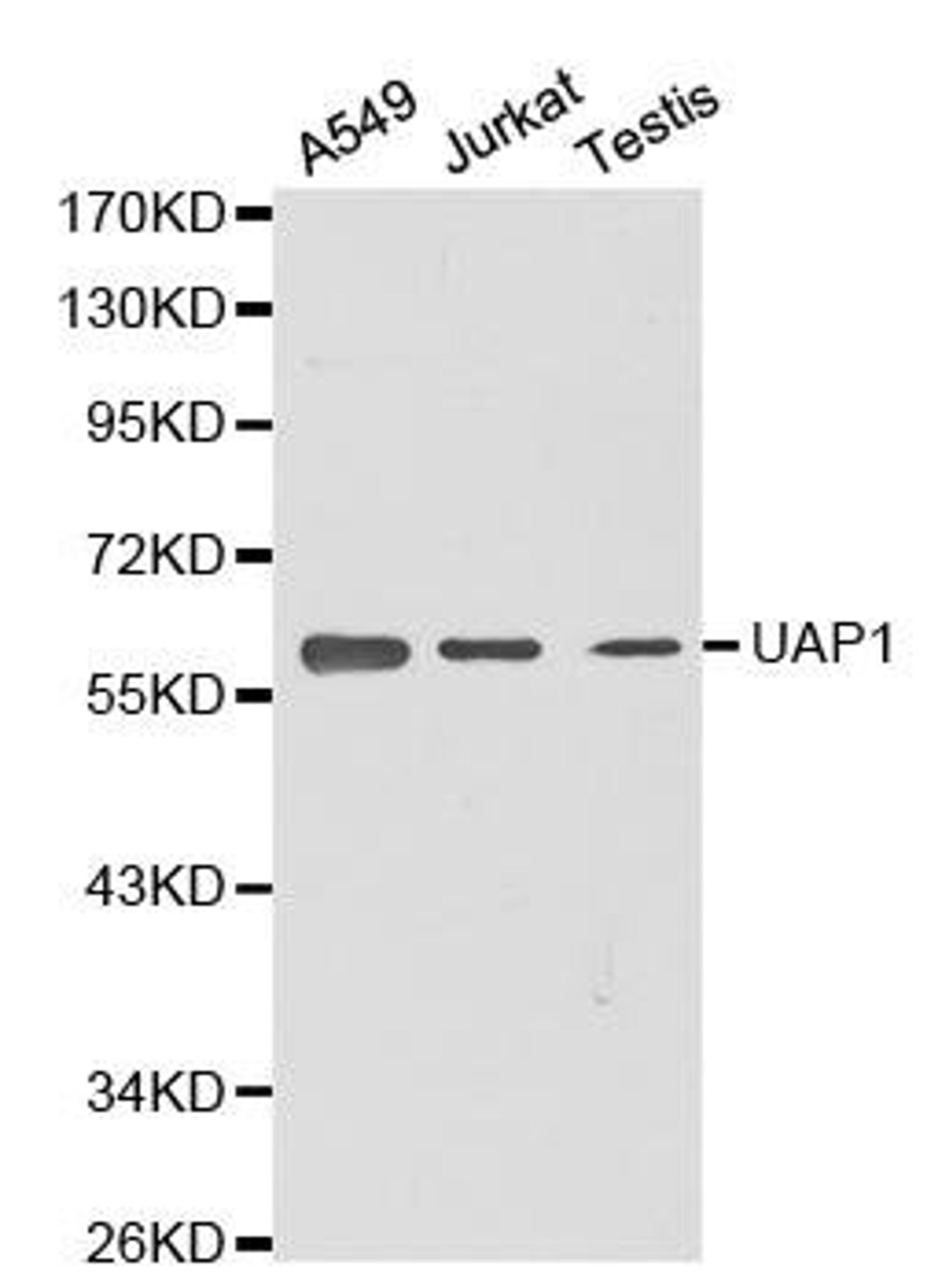 Western blot analysis of extracts of various cell lines using UAP1 antibody