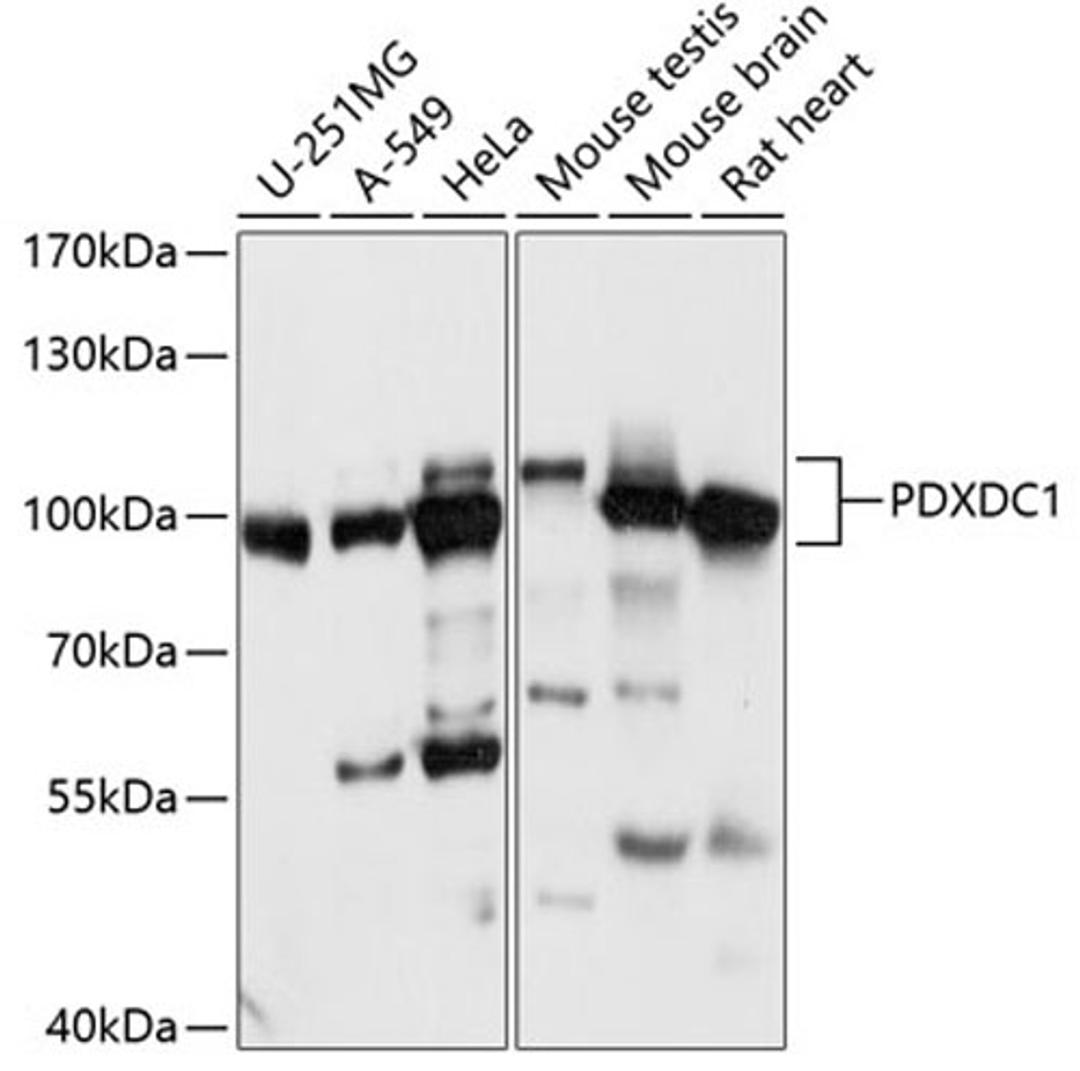 Western blot - PDXDC1 antibody (A14856)