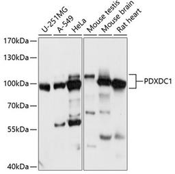 Western blot - PDXDC1 antibody (A14856)