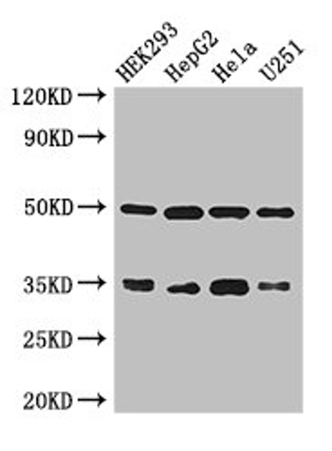 Western Blot. Positive WB detected in: HEK293 whole cell lysate, HepG2 whole cell lysate, Hela whole cell lysate, U251 whole cell lysate. All lanes: LZTFL1 antibody at 3µg/ml. Secondary. Goat polyclonal to rabbit IgG at 1/50000 dilution. Predicted band size: 35, 33, 30 kDa. Observed band size: 35, 50 kDa