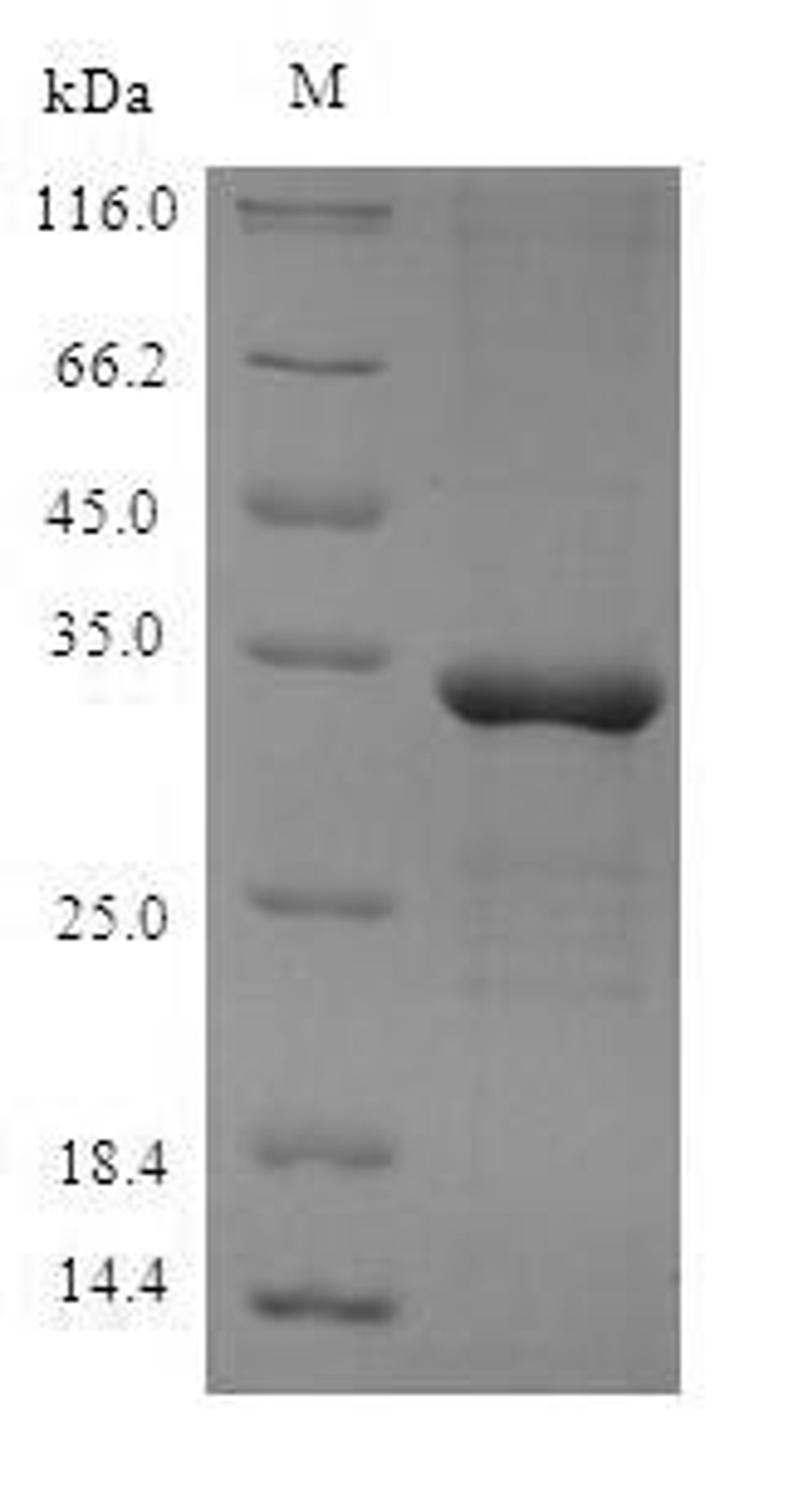 (Tris-Glycine gel) Discontinuous SDS-PAGE (reduced) with 5% enrichment gel and 15% separation gel.