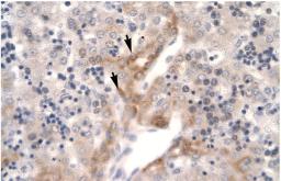 Antibody used in IHC on Human Liver cell lysates.