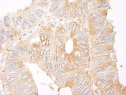 Detection of human Coronin 2 by immunohistochemistry.