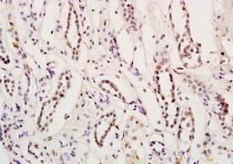 Immunohistochemical analysis of formalin-fixed paraffin embedded human kidney tissue using Myocardin antibody (dilution at 1:200)