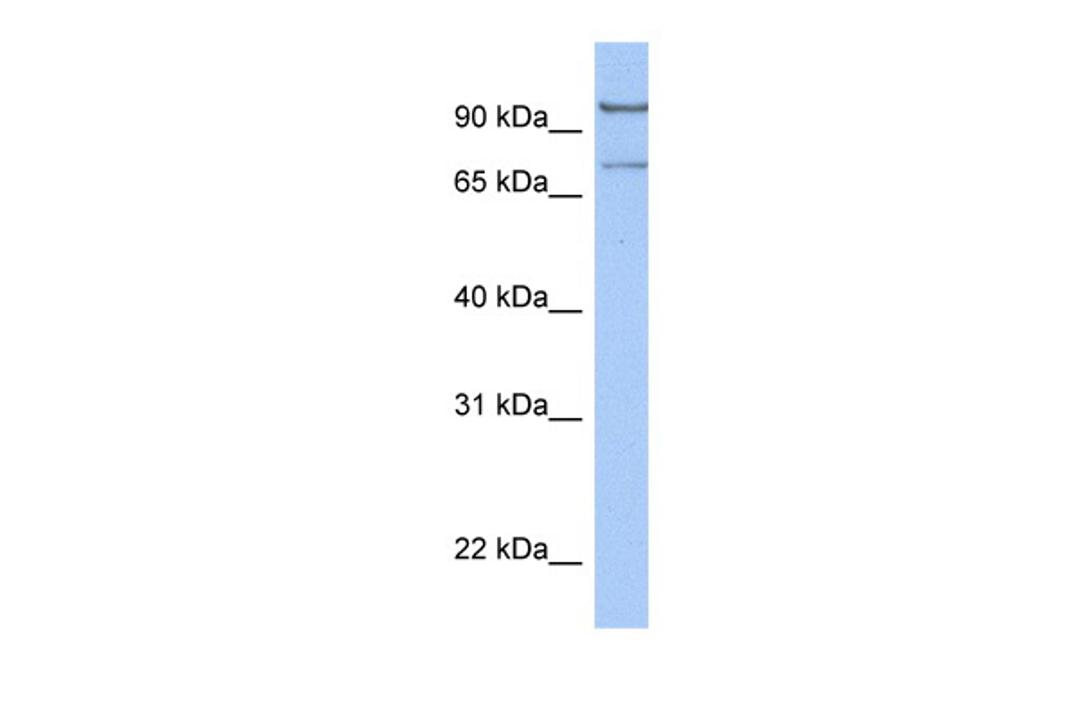 Antibody used in WB on Human HeLa at 0.2-1 ug/ml.