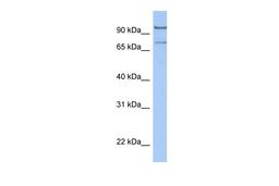 Antibody used in WB on Human HeLa at 0.2-1 ug/ml.