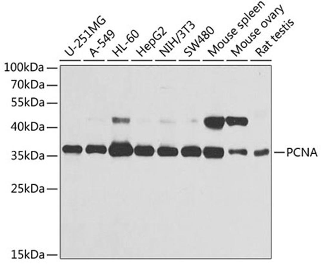 Western blot - PCNA antibody (A13336)