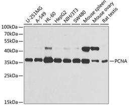 Western blot - PCNA antibody (A13336)