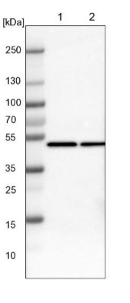 Western Blot: CtBP1 Antibody [NBP1-88707] - Lane 1: NIH-3T3 cell lysate (Mouse embryonic fibroblast cells)<br/>Lane 2: NBT-II cell lysate (Rat Wistar bladder tumour cells)