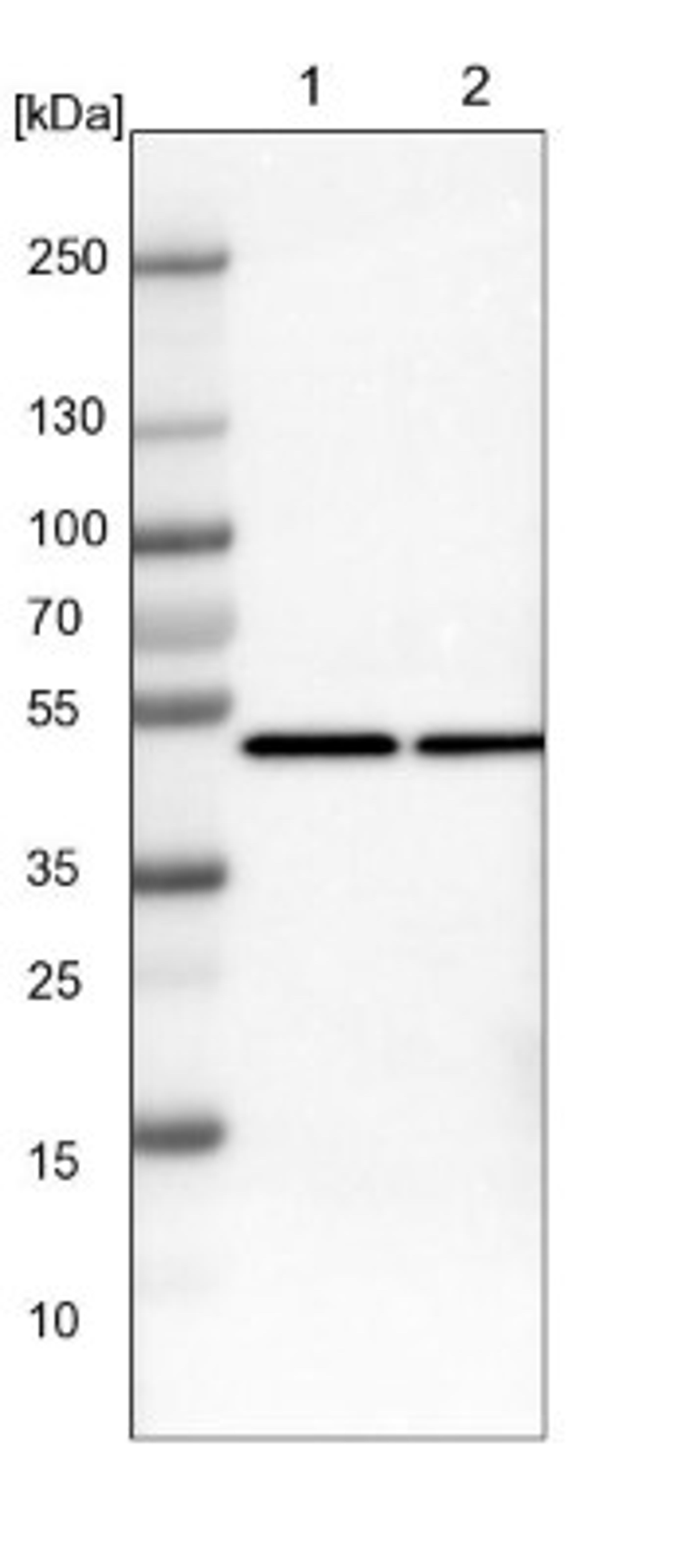 Western Blot: CtBP1 Antibody [NBP1-88707] - Lane 1: NIH-3T3 cell lysate (Mouse embryonic fibroblast cells)<br/>Lane 2: NBT-II cell lysate (Rat Wistar bladder tumour cells)