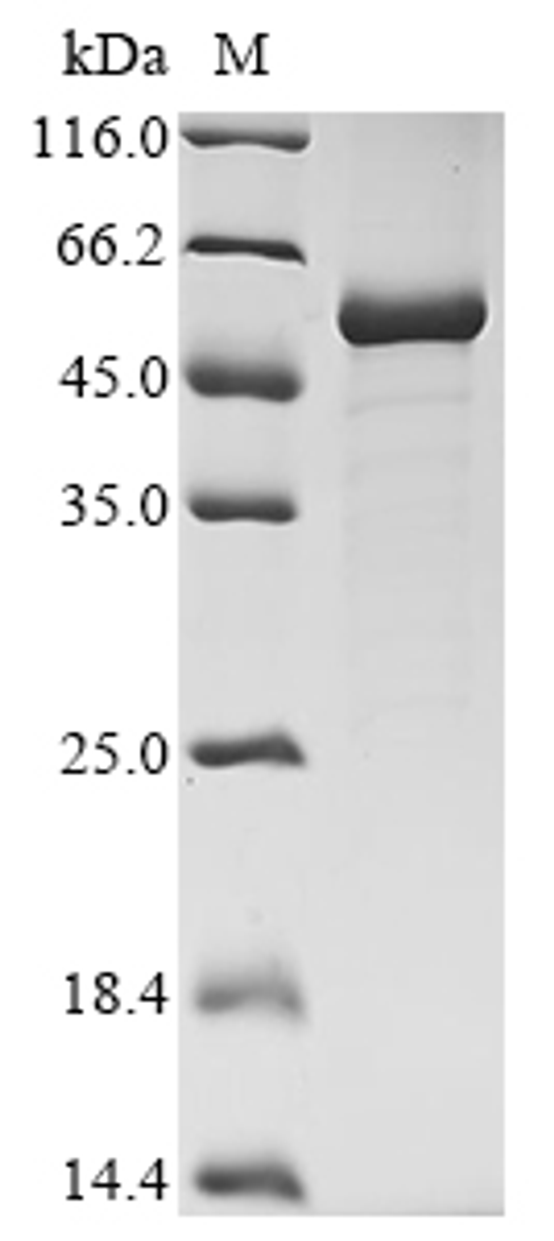 (Tris-Glycine gel) Discontinuous SDS-PAGE (reduced) with 5% enrichment gel and 15% separation gel.