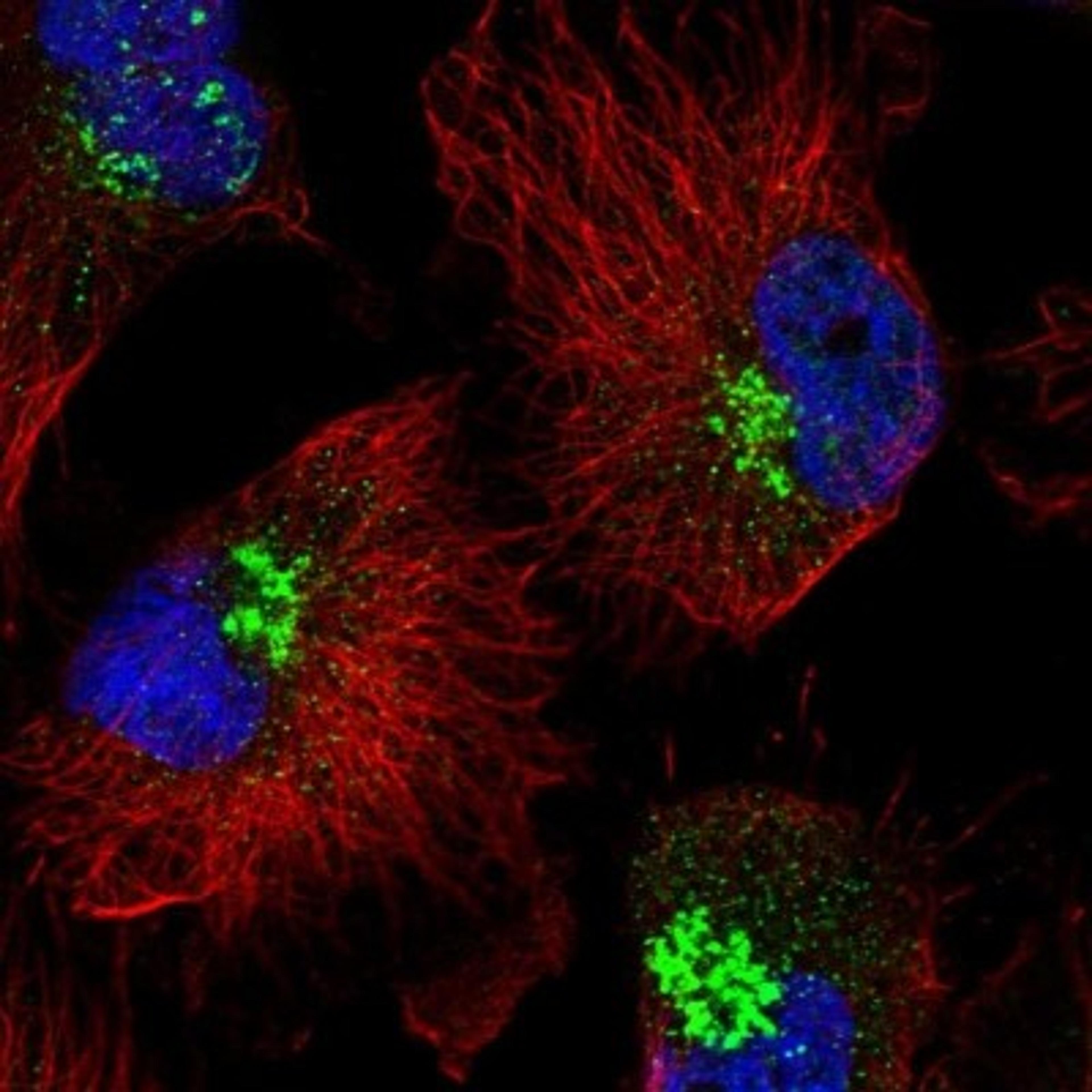 Immunocytochemistry/Immunofluorescence: RHBDD2 Antibody [NBP1-92330] - Staining of human cell line U-251 MG shows positivity in golgi apparatus.