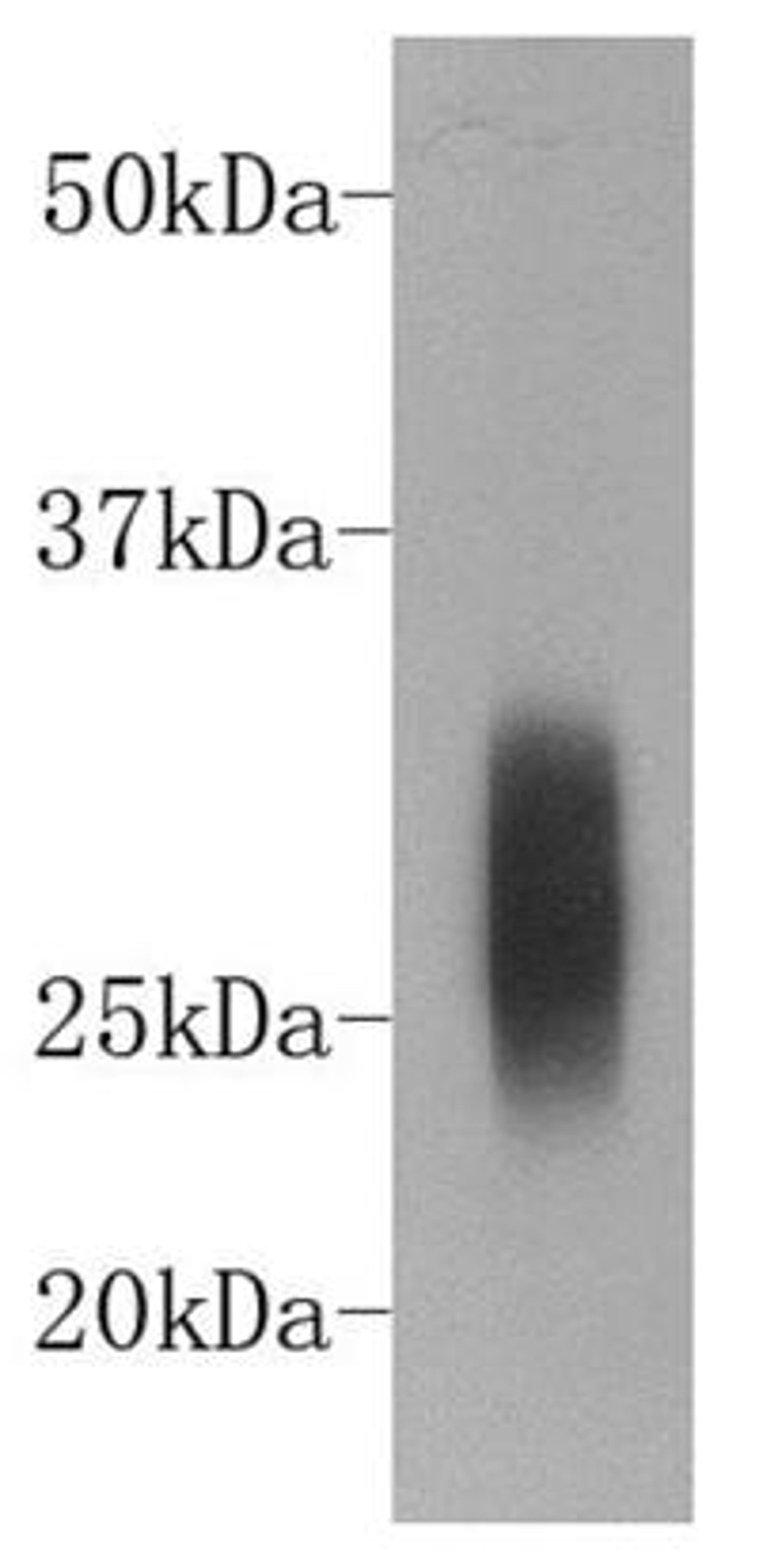 Western blot analysis of rabbit serum using IgG kappa light chain antibody (HRP)