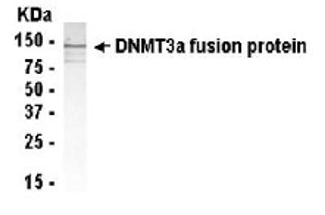 Western Blot: Anti-Dnmt3a antibody XW-7148 at 1/2000 dilution + E.coli. derived Dnmt3a fusion protein. Secondary: HRP conjugated goat anti IgY at 1/1000 dilution. Predicted band size : 109 kDa