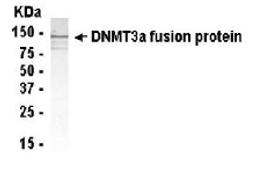 Western Blot: Anti-Dnmt3a antibody XW-7148 at 1/2000 dilution + E.coli. derived Dnmt3a fusion protein. Secondary: HRP conjugated goat anti IgY at 1/1000 dilution. Predicted band size : 109 kDa