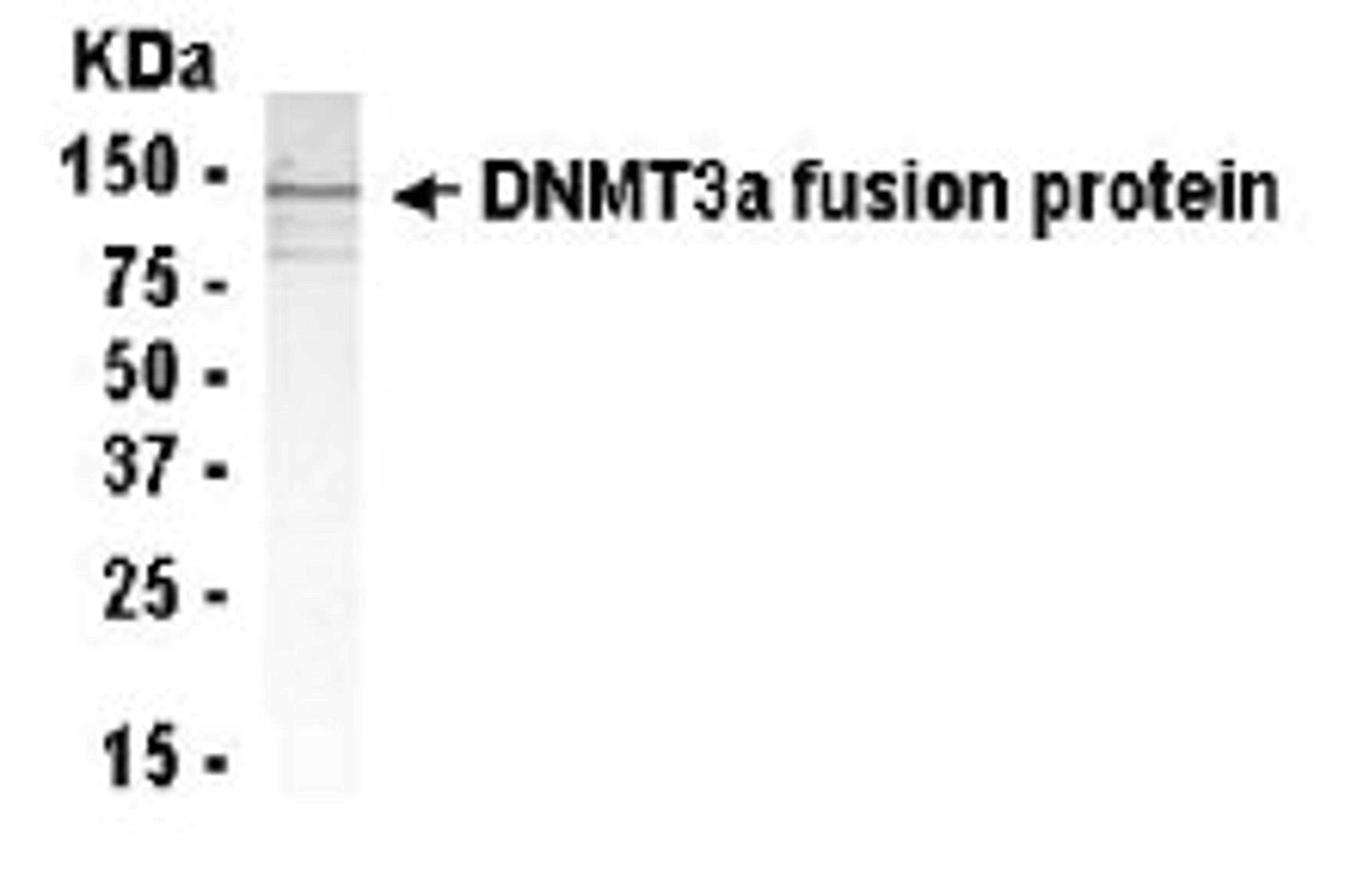 Western Blot: Anti-Dnmt3a antibody XW-7148 at 1/2000 dilution + E.coli. derived Dnmt3a fusion protein. Secondary: HRP conjugated goat anti IgY at 1/1000 dilution. Predicted band size : 109 kDa