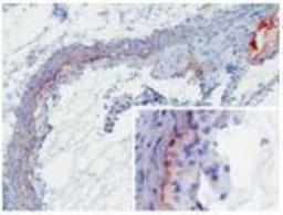 Immunohistochemistry-Frozen: MBL-A Antibody (8G6) [NBP1-60127] - MBL-A (8G6) deposition in developing murine atherosclerotic lesions. Staining of frozen tissue sections with antibody 8G6. Anti-mouse MBL-A at 2ug/ml (2h, RT). MBL-A was detected on the intima to media border as well as throughout the media (insert). Furthermore, extensive MBL-A deposition was seen at sites of necrosis (upper right corner).