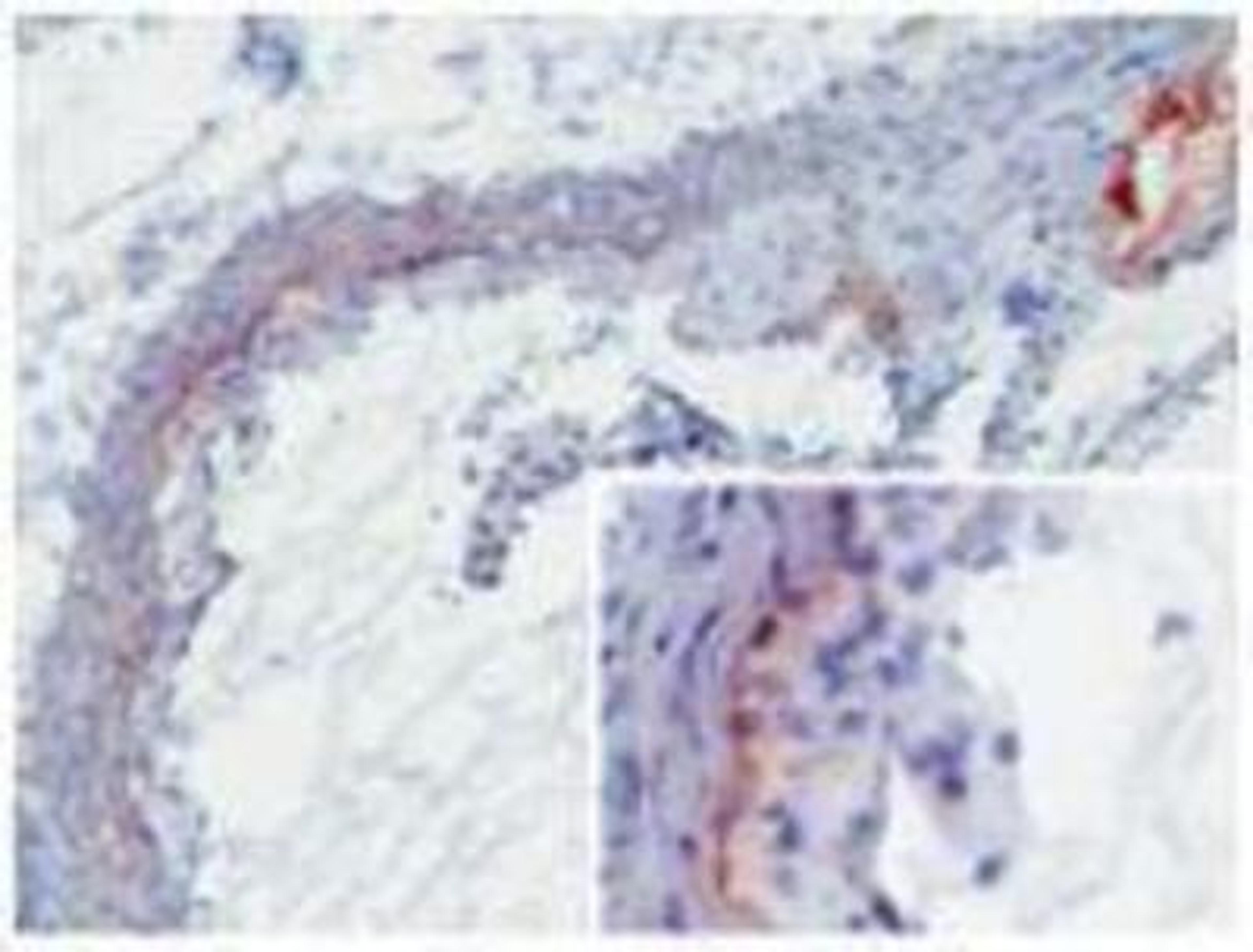 Immunohistochemistry-Frozen: MBL-A Antibody (8G6) [NBP1-60127] - MBL-A (8G6) deposition in developing murine atherosclerotic lesions. Staining of frozen tissue sections with antibody 8G6. Anti-mouse MBL-A at 2ug/ml (2h, RT). MBL-A was detected on the intima to media border as well as throughout the media (insert). Furthermore, extensive MBL-A deposition was seen at sites of necrosis (upper right corner).