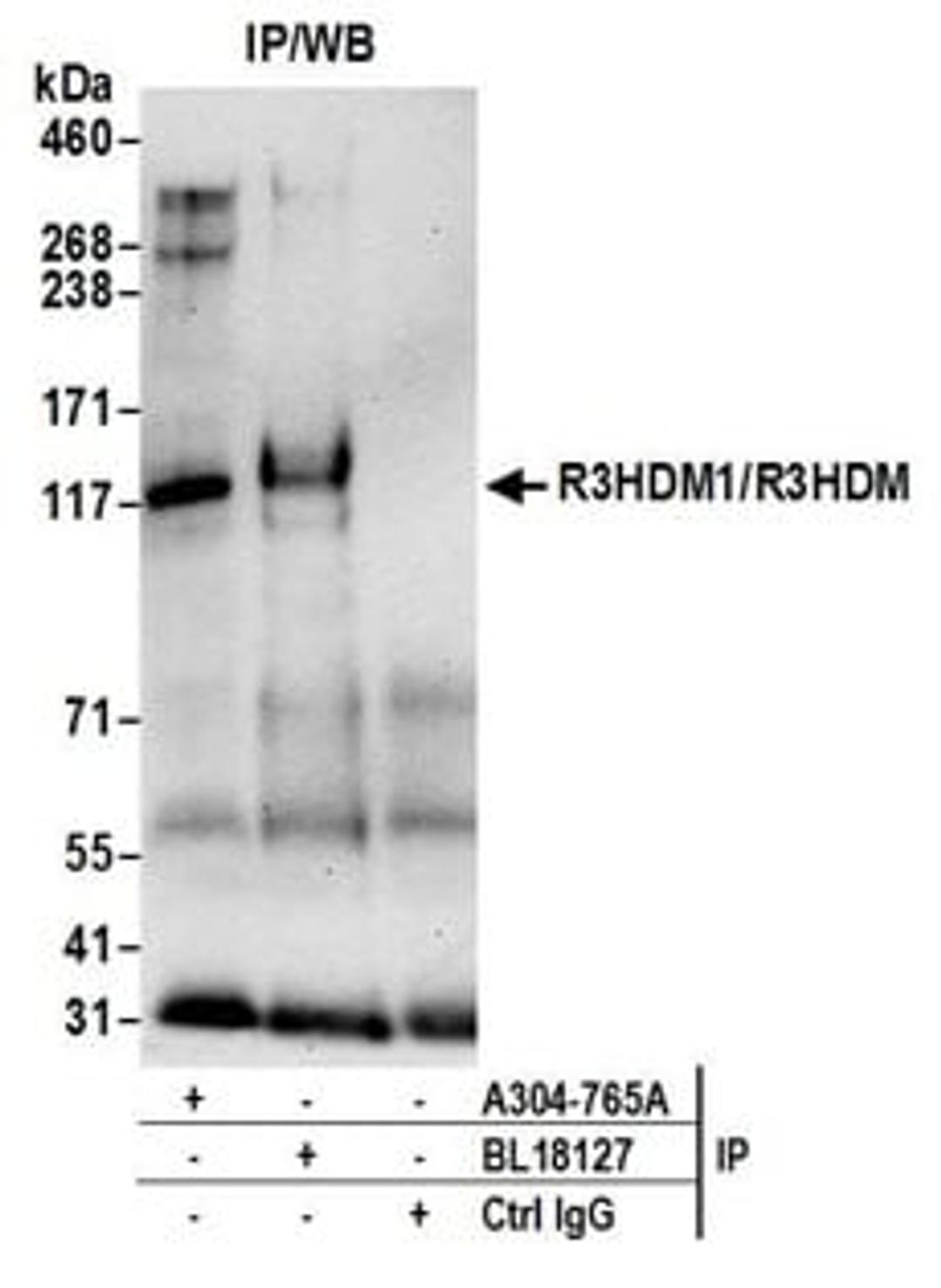 Detection of human R3HDM1/R3HDM by western blot of immunoprecipitates.