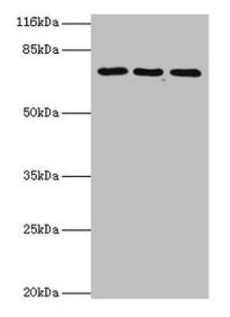 Western blot. All lanes: ZNF699 antibody at 2µg/ml. Lane 1: Jurkat whole cell lysate. Lane 2: K562 whole cell lysate. Lane 3: U87 whole cell lysate. Secondary. Goat polyclonal to rabbit IgG at 1/10000 dilution. Predicted band size: 74 kDa. Observed band size: 74 kDa