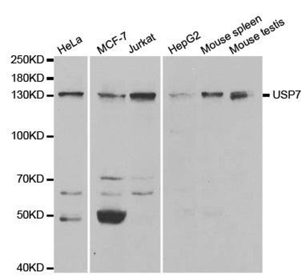 Western blot analysis of extracts of various cell lines using USP7 antibody