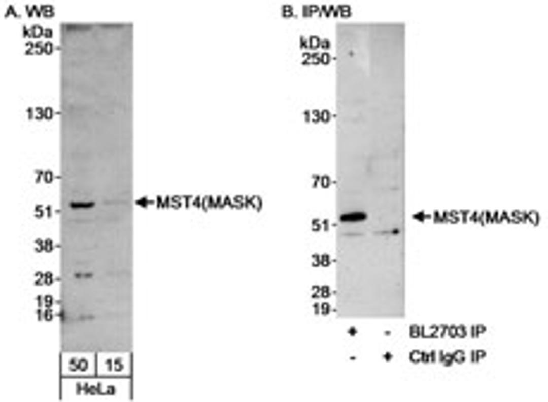 Detection of human MST4(MASK) by western blot and immunoprecipitation.