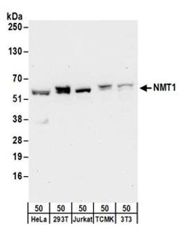 Detection of human and mouse NMT1 by western blot.