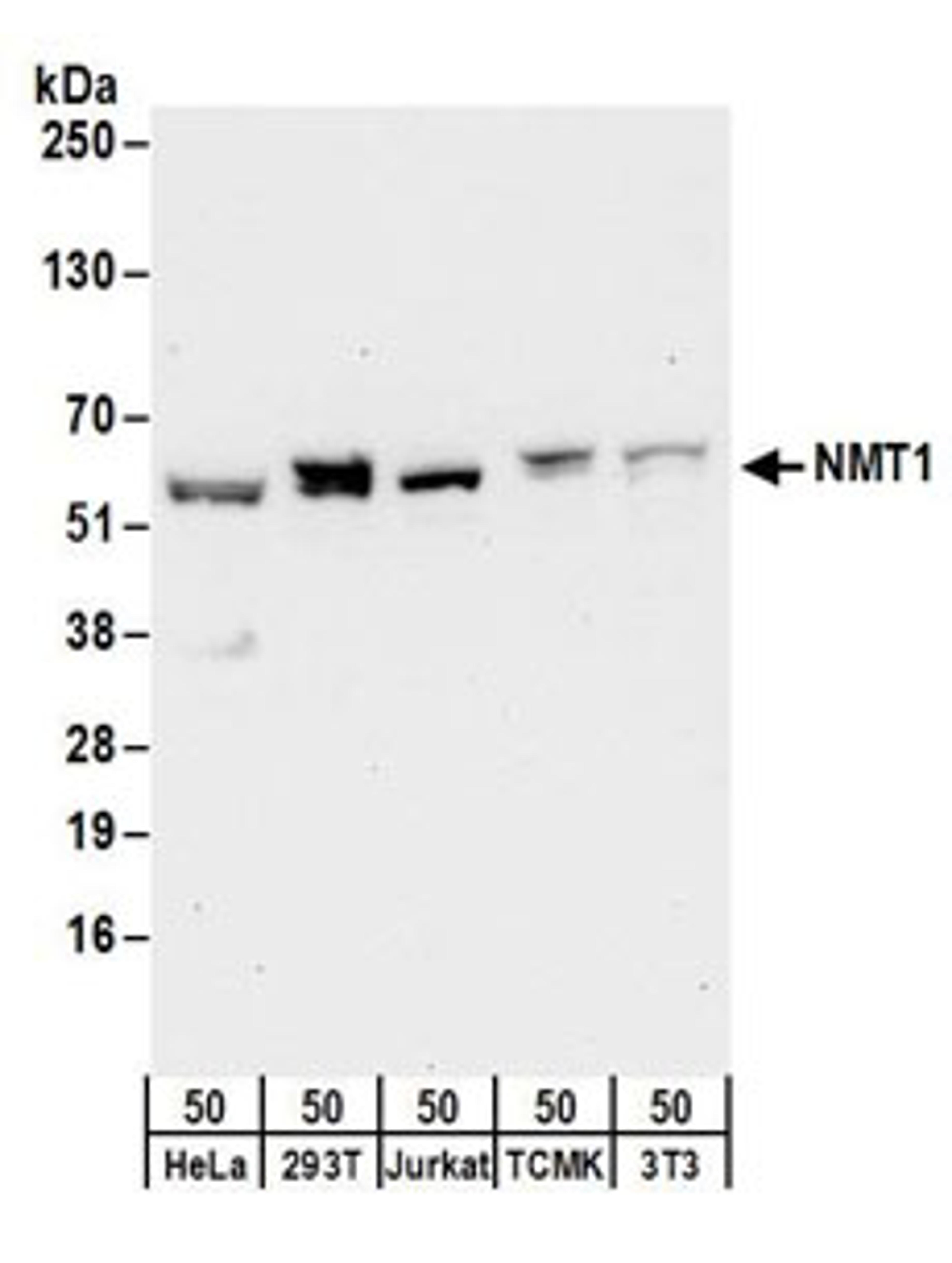 Detection of human and mouse NMT1 by western blot.